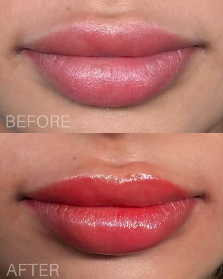 Before-and-after lip blush result
